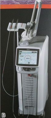 口腔醫(yī)學(xué)中的激光醫(yī)療設(shè)備 原理、應(yīng)用與前景